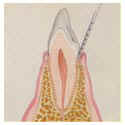 healthy_tooth.jpg (6683 bytes)