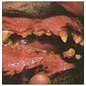 moderate_periodontitis_mouth.jpg (6565 bytes)
